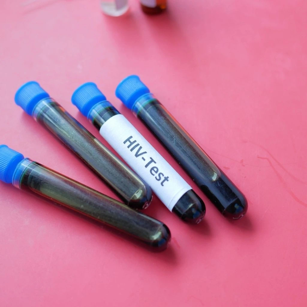 Four HIV test blood samples in vacutainers against a pink background. Medical and laboratory concept